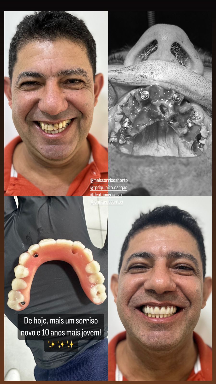 Procedimento realizado